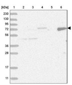 Anti-LIMK1 antibody produced in rabbit Prestige Antibodies® Powered by Atlas Antibodies, affinity isolated antibody, buffered aqueous glycerol solution, ab1