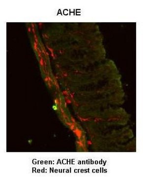 Anti-ACHE, (N-terminal) antibody produced in rabbit affinity isolated antibody