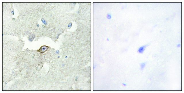 Anti-LMTK2 antibody produced in rabbit affinity isolated antibody