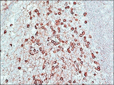 过氧化物酶抗过氧化物酶可溶性复合物 兔抗 affinity isolated antibody, buffered aqueous solution