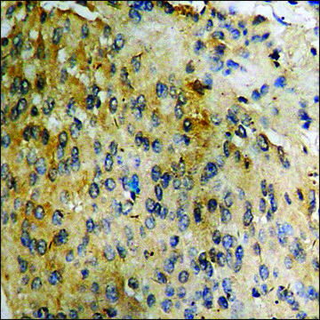 Anti-phospho-Tau (pSer356) antibody produced in rabbit affinity isolated antibody