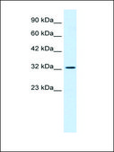 Anti-SMARCA2 antibody produced in rabbit affinity isolated antibody