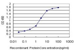 Monoclonal Anti-PIP5K1C antibody produced in mouse clone 7D11, purified immunoglobulin, buffered aqueous solution