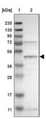 Anti-SLC41A1 antibody produced in rabbit Prestige Antibodies® Powered by Atlas Antibodies, affinity isolated antibody, buffered aqueous glycerol solution