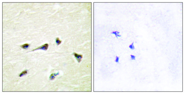 Anti-AKAP12 antibody produced in rabbit affinity isolated antibody