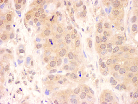 Rabbit anti-USP8 Antibody, Affinity Purified Powered by Bethyl Laboratories, Inc.