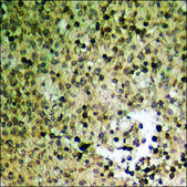 Anti-phospho-HER2 (pTyr877) antibody produced in rabbit affinity isolated antibody