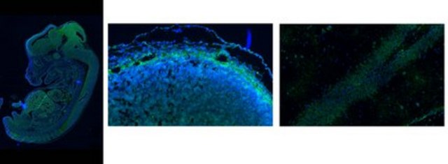 Anti-Neurocan Antibody, C-terminal from rabbit