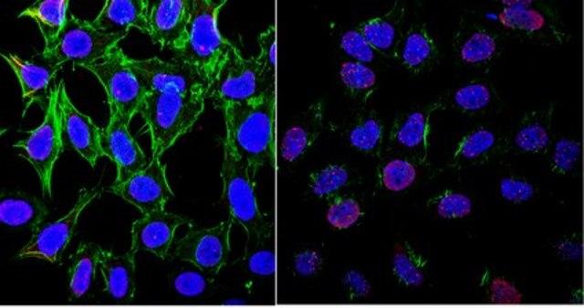 Anti-phospho-ATM (Ser1981) Antibody, clone 10H11.E12, Ascites Free clone 10H11.E12, from mouse