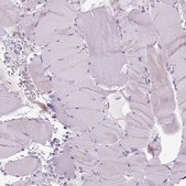 Anti-ADGRV1 antibody produced in rabbit Prestige Antibodies® Powered by Atlas Antibodies, affinity isolated antibody