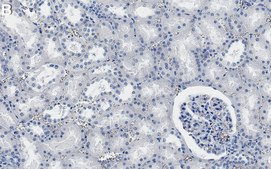 Anti-UBE2D1/UbcH5 Antibody, clone 1F22 ZooMAb® Rabbit Monoclonal recombinant, expressed in HEK 293 cells