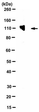 Anti-Neuroligin-4