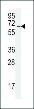 ANTI-SAE2 (UBA2) (C-TERM E616) antibody produced in rabbit IgG fraction of antiserum, buffered aqueous solution