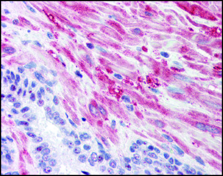 Anti-GYS1 antibody produced in rabbit affinity isolated antibody, buffered aqueous solution