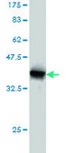 Monoclonal Anti-SMG1 antibody produced in mouse clone 1G5, purified immunoglobulin, buffered aqueous solution