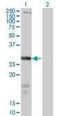 Anti-SLC39A3 antibody produced in mouse purified immunoglobulin, buffered aqueous solution