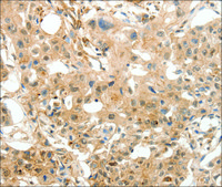 Anti-COL4A1 antibody produced in rabbit affinity isolated antibody