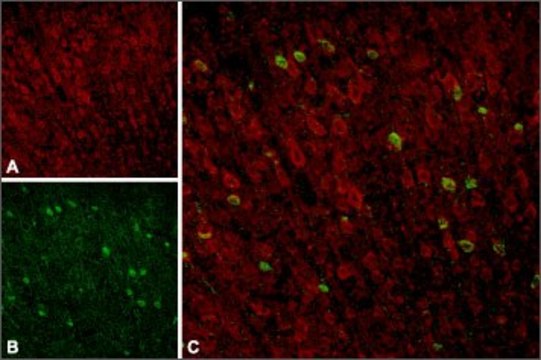 Anti-Sortilin 兔抗 lyophilized powder, affinity isolated antibody