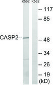 Anti-CASP2 antibody produced in rabbit affinity isolated antibody