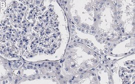 Anti-VEGFR-2 Antibody, clone 3C21 ZooMAb® Rabbit Monoclonal recombinant, expressed in HEK 293 cells