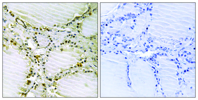 Anti-AMPD1 antibody produced in rabbit affinity isolated antibody