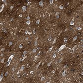 Anti-BLOC1S1 antibody produced in rabbit Prestige Antibodies® Powered by Atlas Antibodies, affinity isolated antibody, buffered aqueous glycerol solution