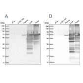 Anti-ALB antibody produced in rabbit Prestige Antibodies® Powered by Atlas Antibodies, affinity isolated antibody, buffered aqueous glycerol solution