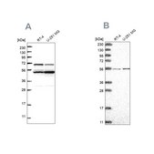 Anti-COQ8B antibody produced in rabbit Prestige Antibodies® Powered by Atlas Antibodies, affinity isolated antibody, buffered aqueous glycerol solution, ab3