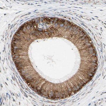 Anti-RPN2 antibody produced in rabbit affinity isolated antibody, buffered aqueous glycerol solution