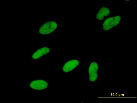 Anti-SMARCA5 antibody produced in mouse purified immunoglobulin, buffered aqueous solution