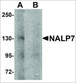 Anti-NALP7 antibody produced in rabbit affinity isolated antibody, buffered aqueous solution