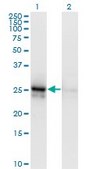 Monoclonal Anti-ALDOA antibody produced in mouse clone 3D9-6F3, purified immunoglobulin, buffered aqueous solution