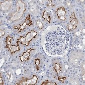 Anti-SLC34A3 antibody produced in rabbit Prestige Antibodies® Powered by Atlas Antibodies, affinity isolated antibody, buffered aqueous glycerol solution