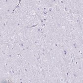 Anti-CD27 antibody produced in rabbit Prestige Antibodies® Powered by Atlas Antibodies, affinity isolated antibody, buffered aqueous glycerol solution