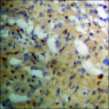 Anti-phospho-PKC &#945; (pTyr658) antibody produced in rabbit affinity isolated antibody