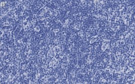 Anti-PD-1 Antibody, clone 1F7 ZooMAb® Rabbit Monoclonal recombinant, expressed in HEK 293 cells
