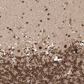 Anti-CBLL1 antibody produced in rabbit Prestige Antibodies® Powered by Atlas Antibodies, affinity isolated antibody, buffered aqueous glycerol solution, Ab1