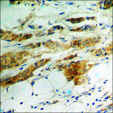 Anti-phospho-eIF2 &#945; (pSer51) antibody produced in rabbit affinity isolated antibody