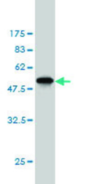 ANTI-AK1 antibody produced in mouse clone 4C2-1A8, purified immunoglobulin, buffered aqueous solution