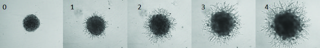 Cultrex&#8482; 3-D Spheroid Cell Invasion Assay