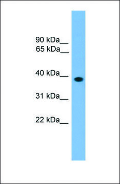 Anti-LHX8, (N-terminal) antibody produced in rabbit affinity isolated antibody