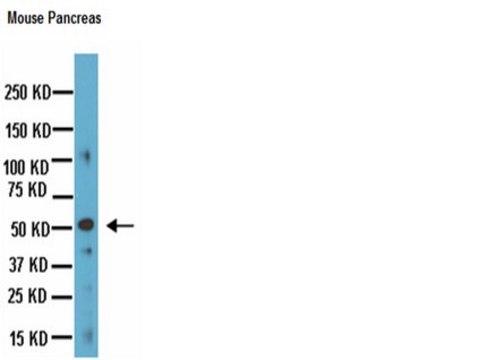 Anti-Chromogranin A Antibody, clone LK2H10 clone LK2H10, Chemicon&#174;, from mouse