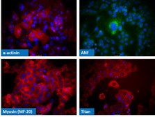 HL-1 Cardiac Muscle Cell Line HL-1 Cardiac Muscle Cell Line has been extensively characterized and is a valuable model system to address questions of cardiac biology at the cellular &amp; molecular levels.