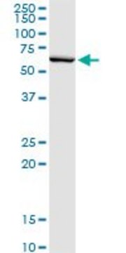 Monoclonal Anti-SERPINB2 antibody produced in mouse clone 3A9, purified immunoglobulin, buffered aqueous solution