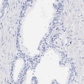 Anti-C1QTNF6 antibody produced in rabbit Prestige Antibodies® Powered by Atlas Antibodies, affinity isolated antibody, buffered aqueous glycerol solution
