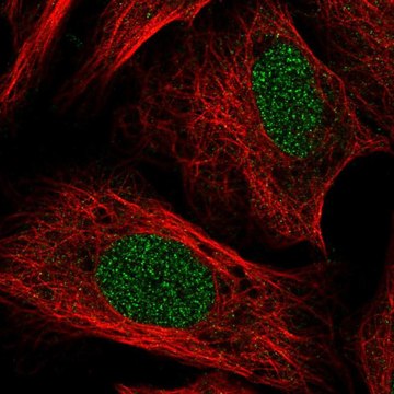 抗-TOX 兔抗 Prestige Antibodies&#174; Powered by Atlas Antibodies, affinity isolated antibody