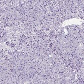 Anti-CREG2 antibody produced in rabbit Prestige Antibodies® Powered by Atlas Antibodies, affinity isolated antibody, buffered aqueous glycerol solution