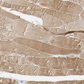 Anti-USP46 antibody produced in rabbit Prestige Antibodies® Powered by Atlas Antibodies, affinity isolated antibody, buffered aqueous glycerol solution