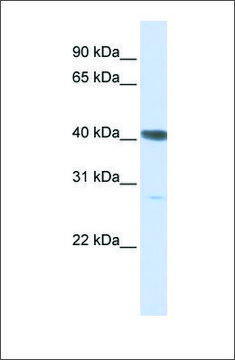 Anti-DNAJB11 antibody produced in rabbit affinity isolated antibody