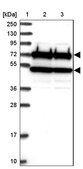 Anti-CDC16 antibody produced in rabbit Prestige Antibodies® Powered by Atlas Antibodies, affinity isolated antibody, buffered aqueous glycerol solution